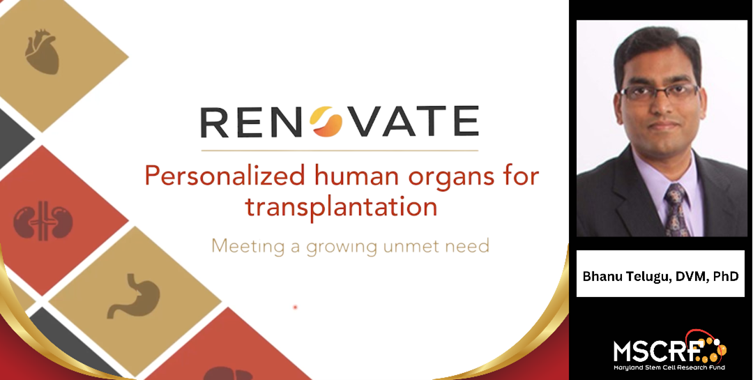 Renovate: Personalized human organs for transplantation